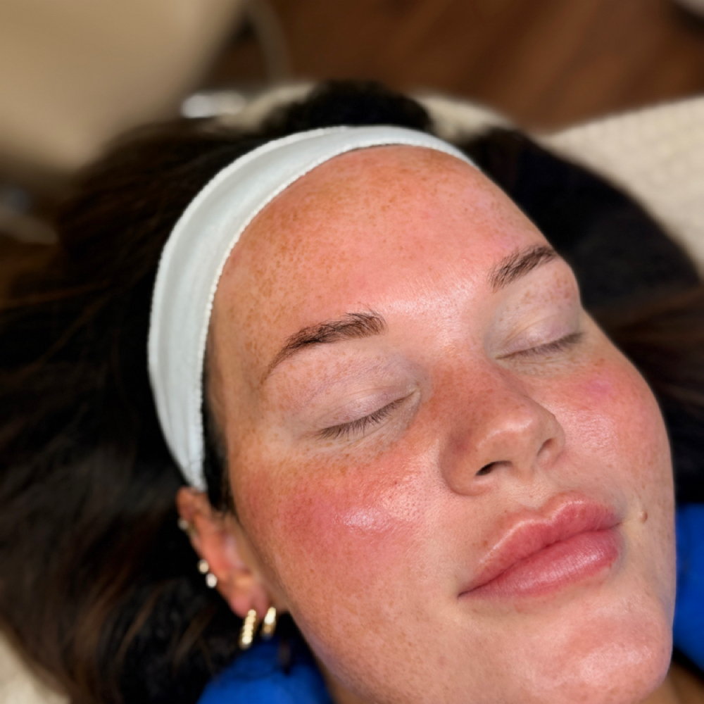 Deluxe Hydrafacial at Kschaff aesthetics in Morristown, TN