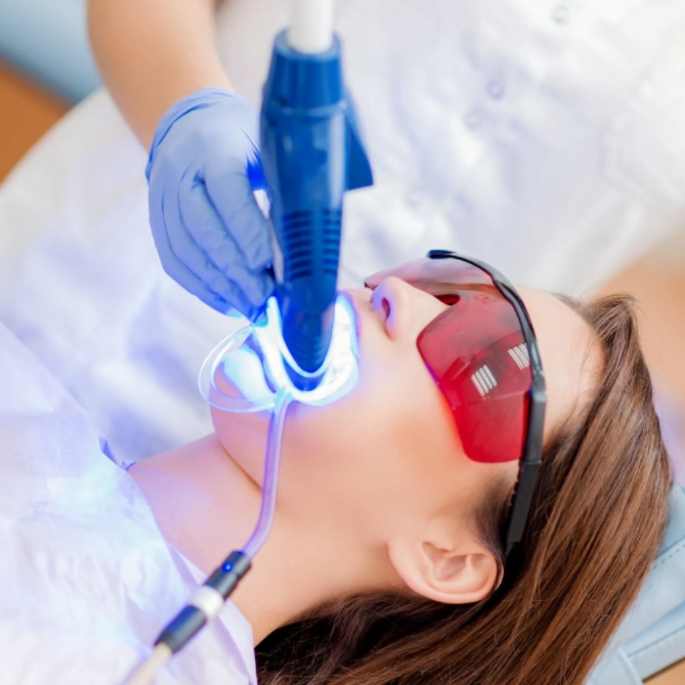 Tooth Gems + Teeth Whitening at Le Petit Spa in La Center, WA