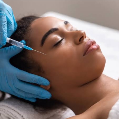Facial Fillers at E.V. Aesthetics in Torrance, CA