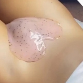 Brazilian Wax +Hydrojelly Treatment at Reflections Skin Co. in Angels Camp, CA