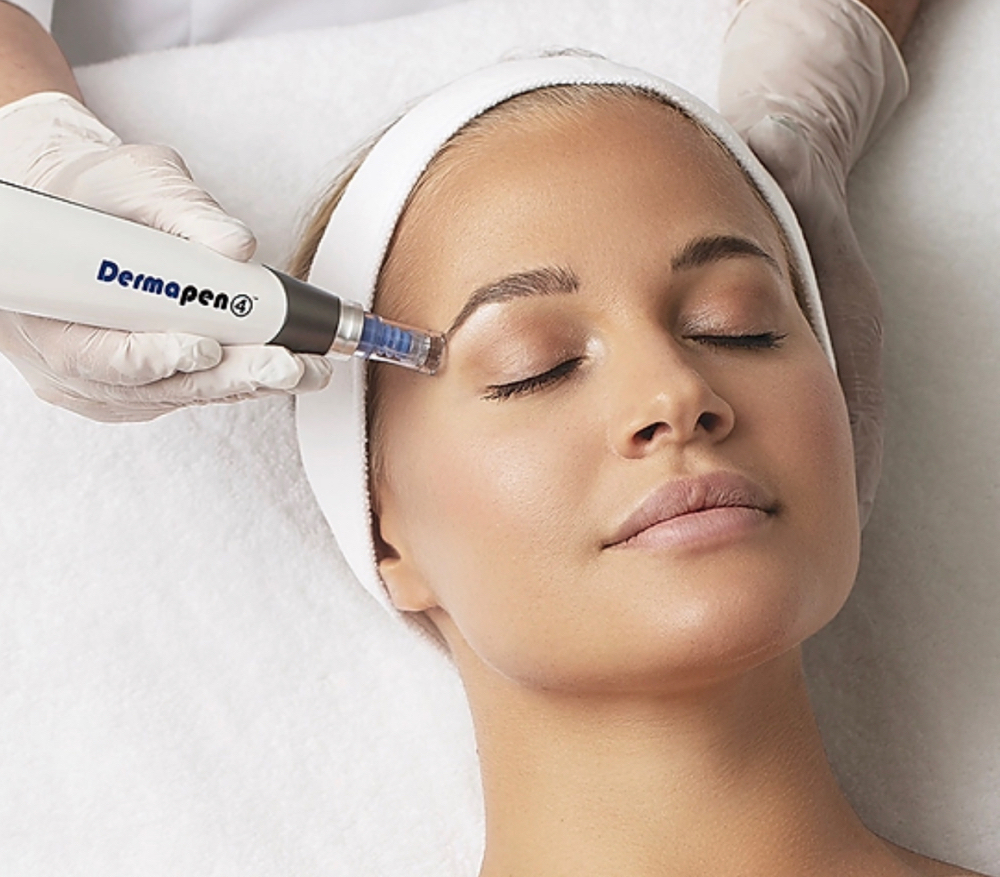 Microneedling