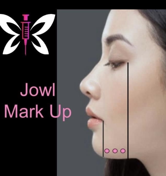Toxin-Jowls