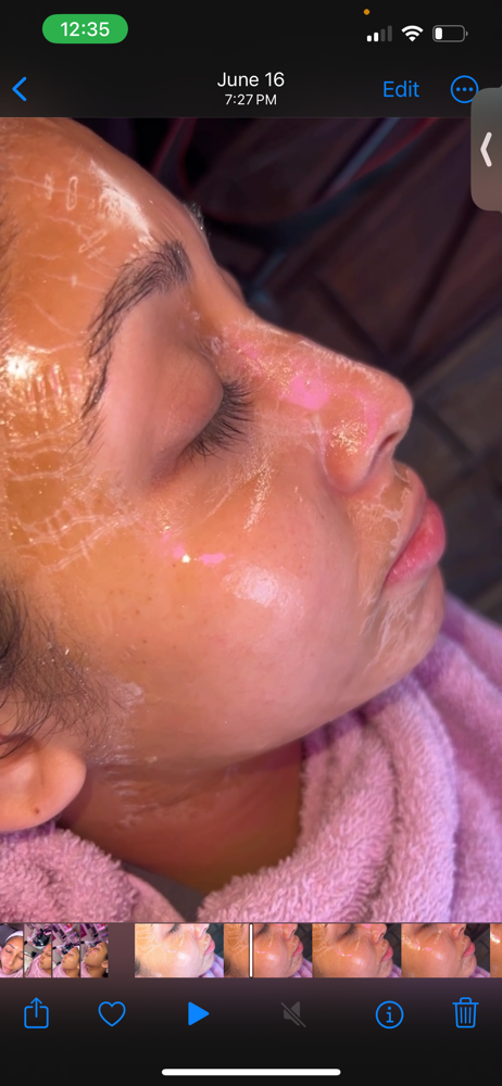 Firm & Lift Botox Facial