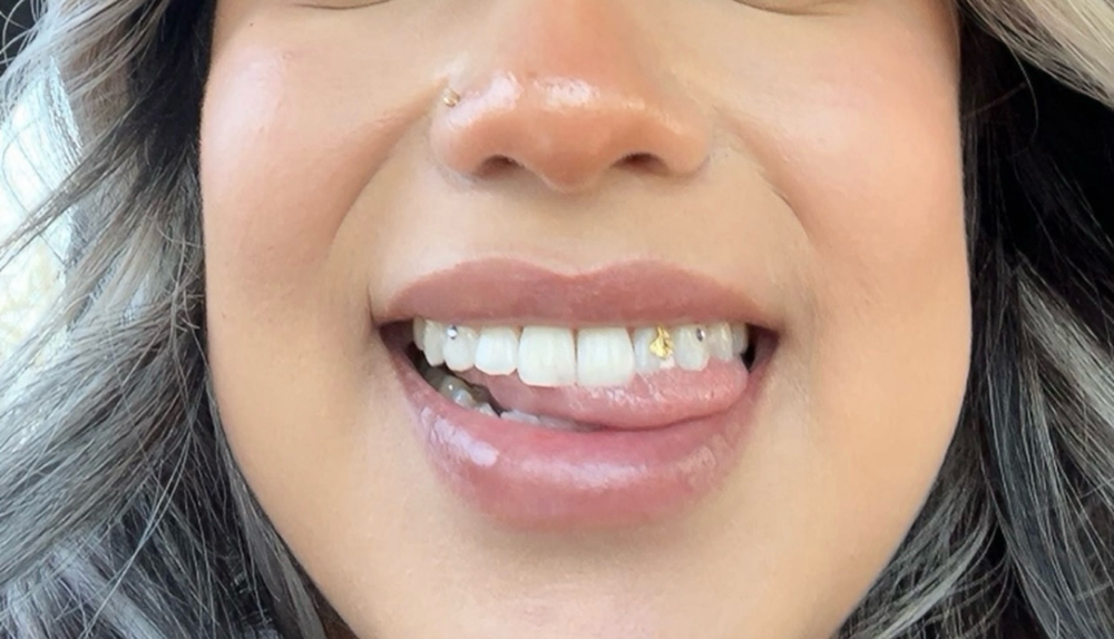 Two Circle Shaped Tooth Gems