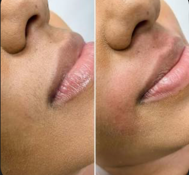 Lip Wax