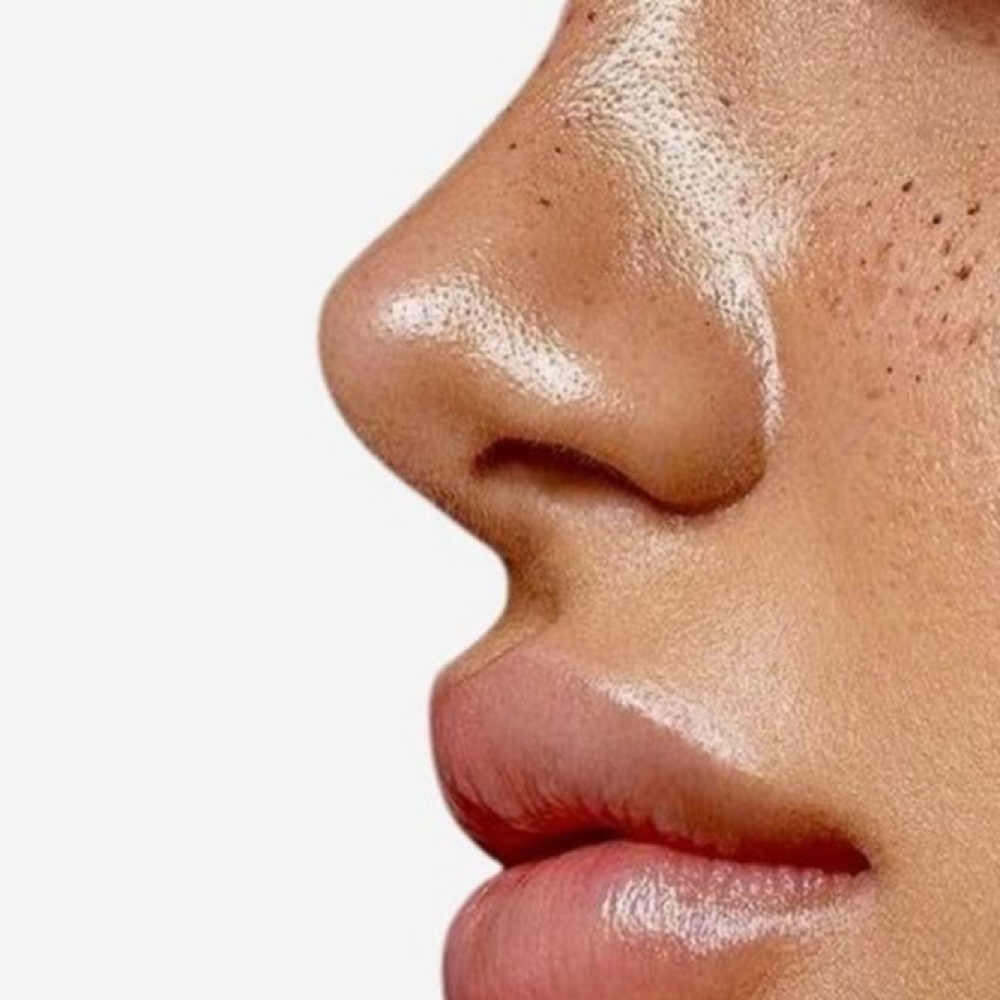 Nose Filler at Sharon Nicole Aesthetics in Patchogue, NY