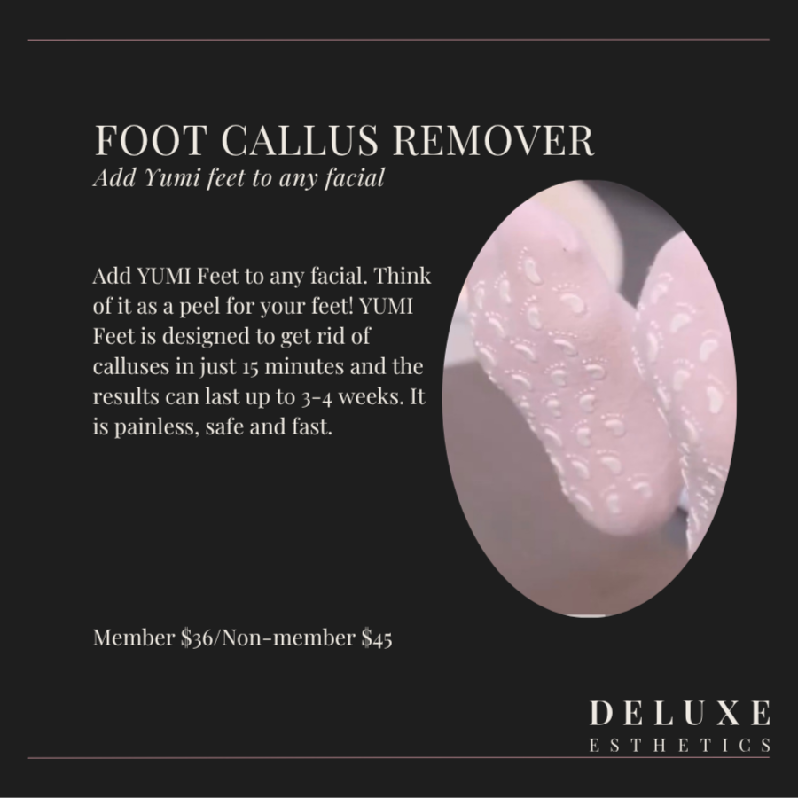 Foot Callus Remover at Deluxe Esthetics in St. Petersburg, FL
