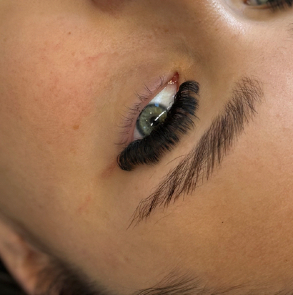 Mega Volume Fill at Alycia Moreo in Canal Winchester, OH