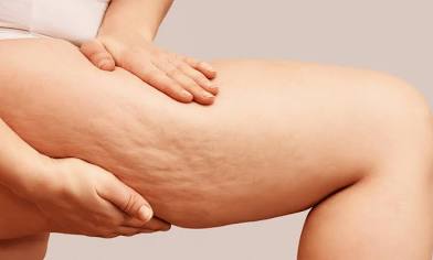 Cellulite Wrap at Skin Remedy in Russell, KY
