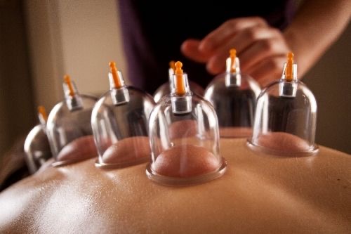 Cupping