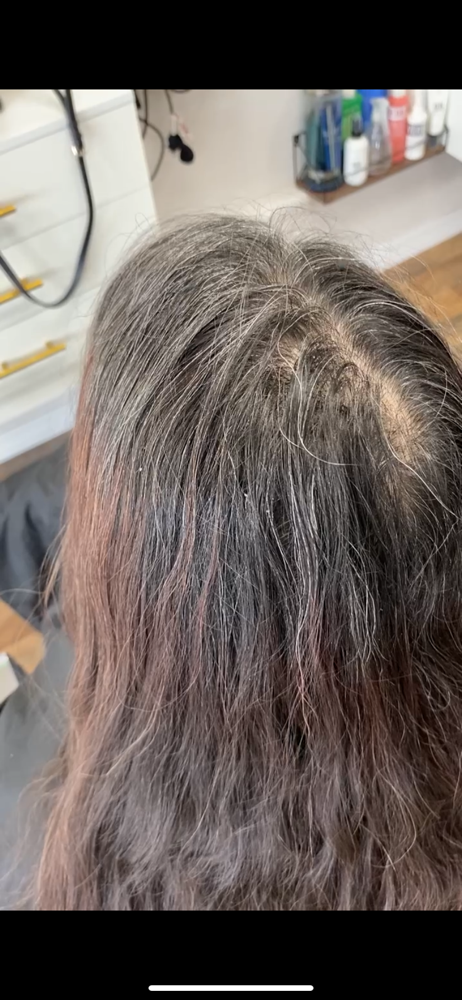 Root Touchup
