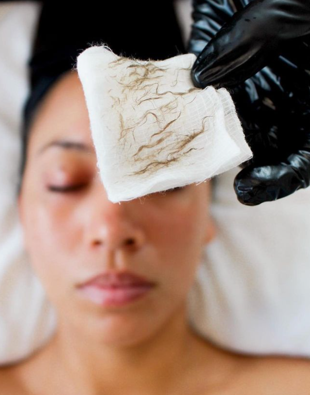 Dermaplane Facial