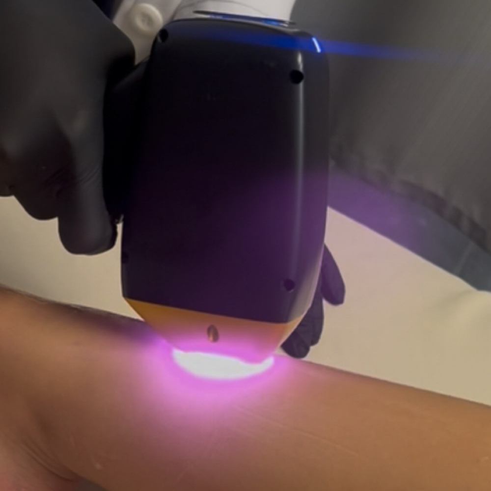 Laser Hair Removal Waitlist at House of Pearls Aesthetics LLC in Las Vegas, NV