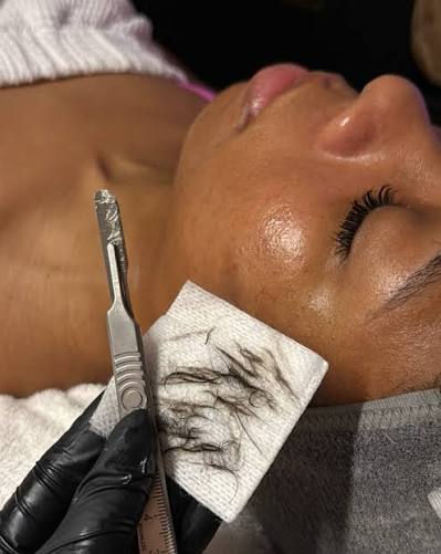Black Friday Sale-Dermaplane Facial