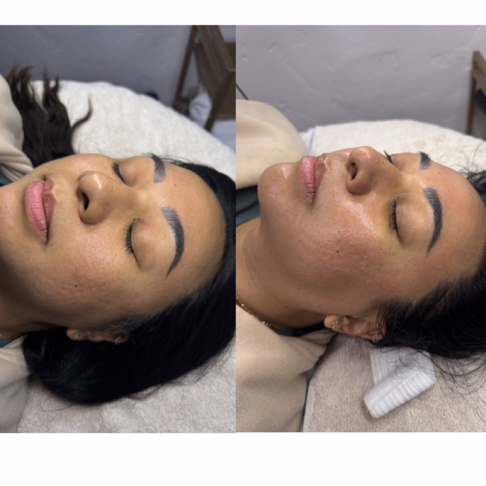 ✨First Time Client Special✨ at Skiin Pro Studio in Baldwin Park, CA