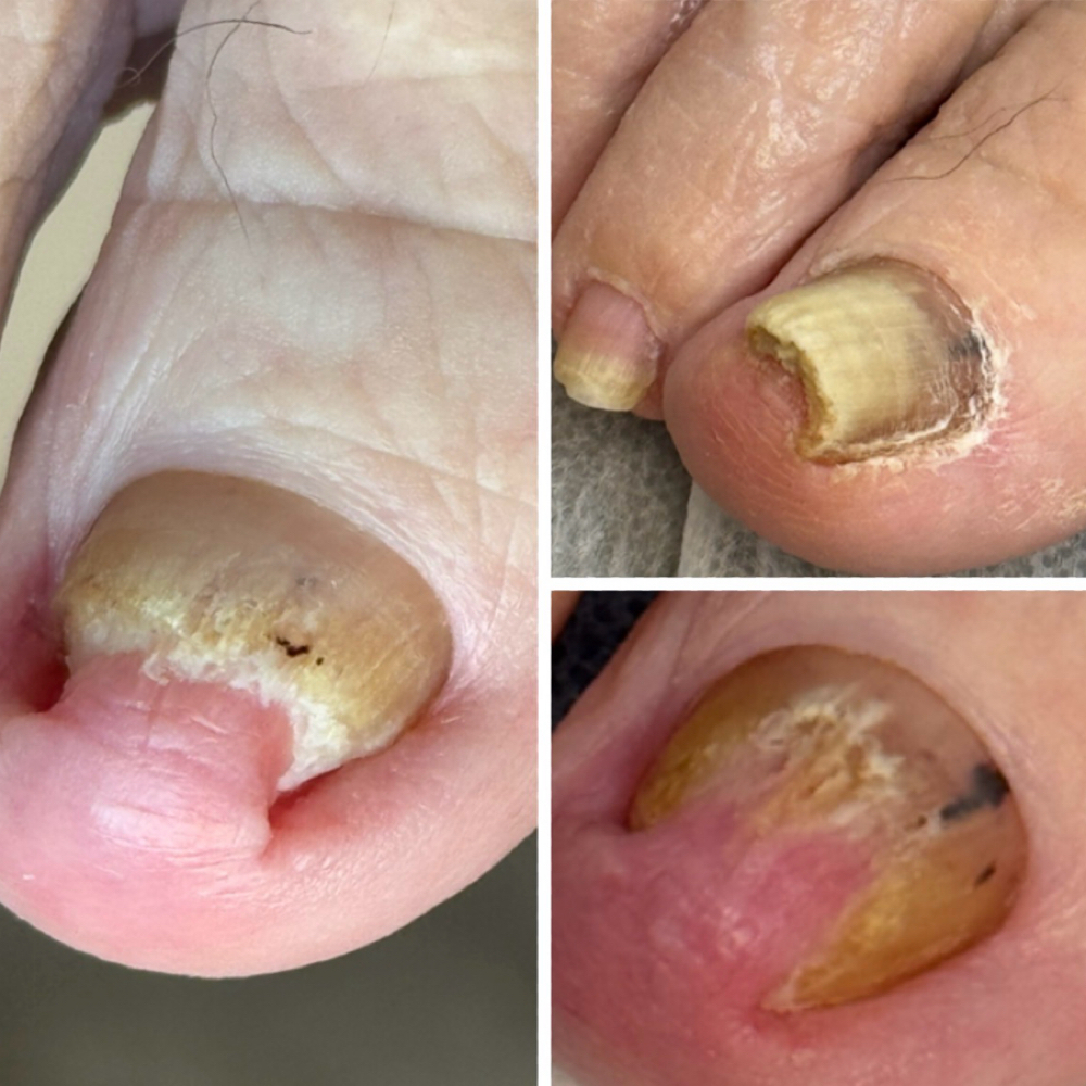 Podo-  Redicure at Nailya Beauty in Boca Raton, FL