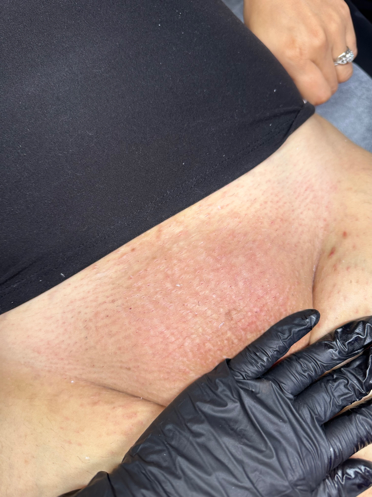 Brazilian Wax