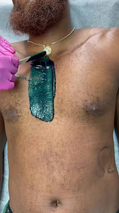 Chest Waxing