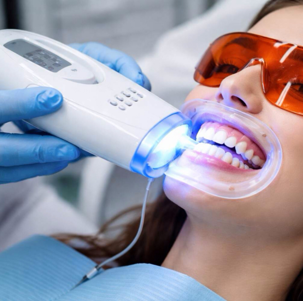 Laser Teeth Whitening at Tiny Rituals in Delmar, NY