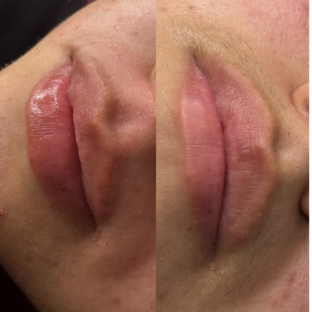 Upperlip Wax