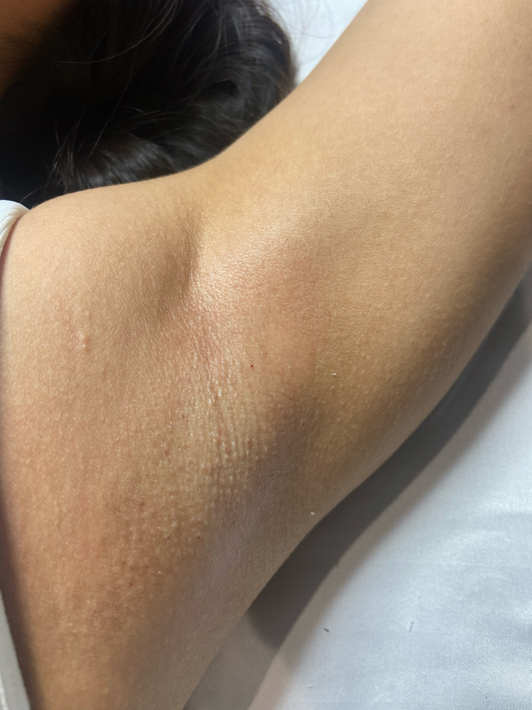Underarm Wax