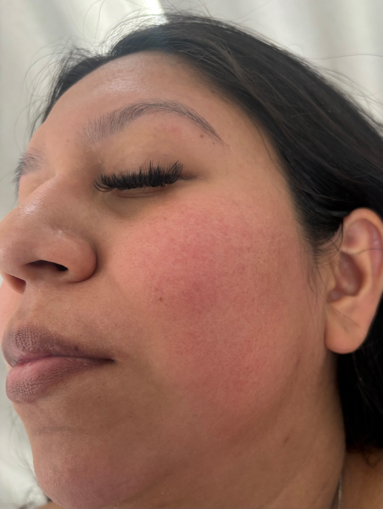 side burn threading