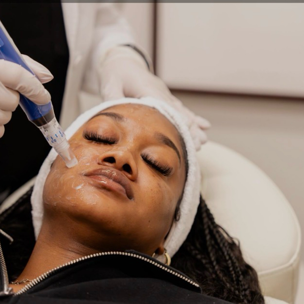 Microneedling at Spatium Urgent Care & Wellness in Marietta, GA