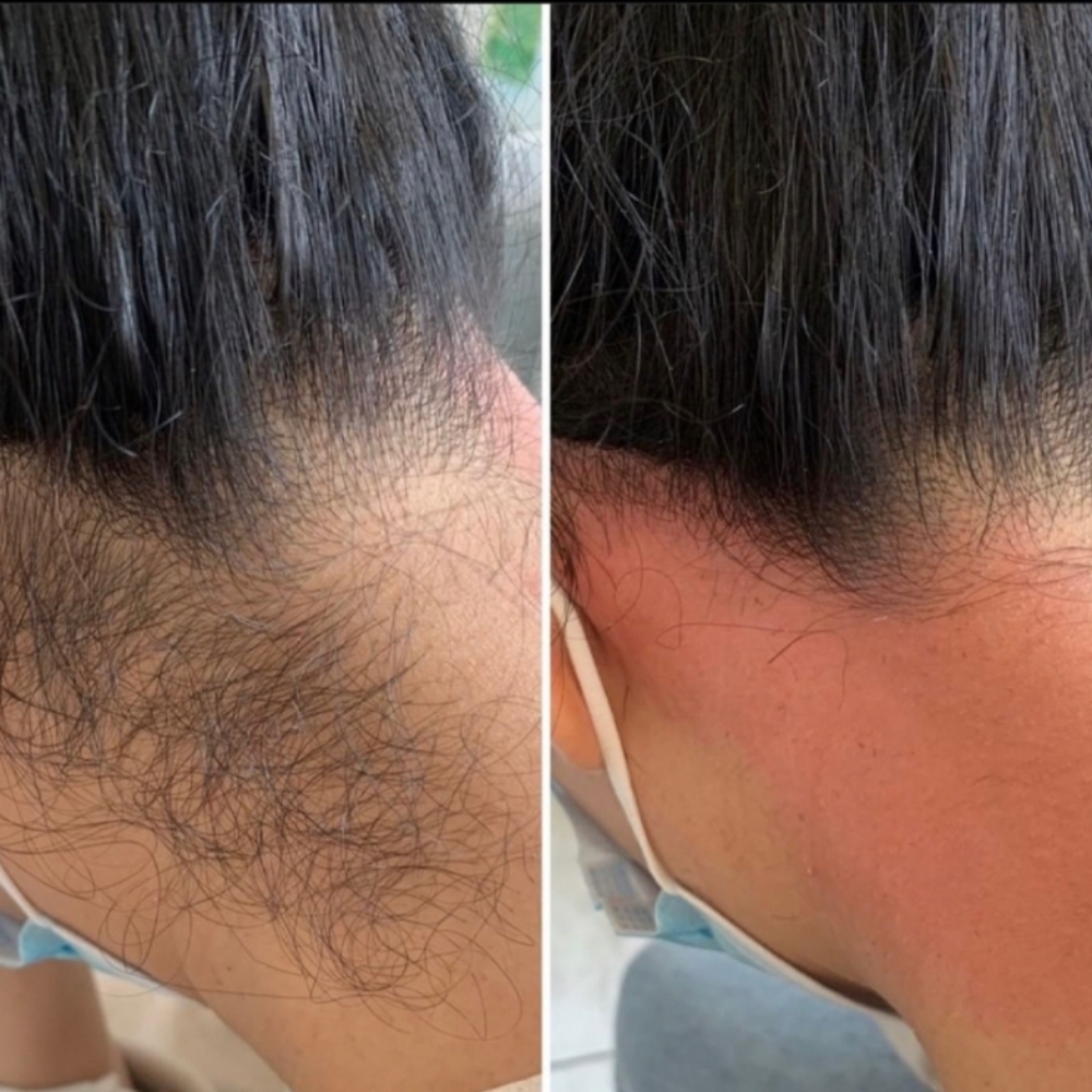 Neck & Hairline Wax at Beautiful Creations Studio in Colorado Springs, CO