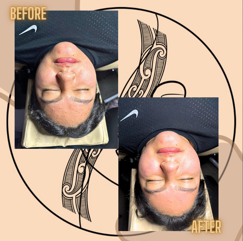 Rejuvenation Basic Facial at Mana Aesthetics in Las Vegas, NV