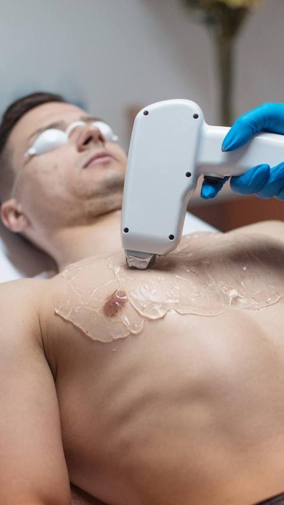 PECHO Y ABDOMEN LASER