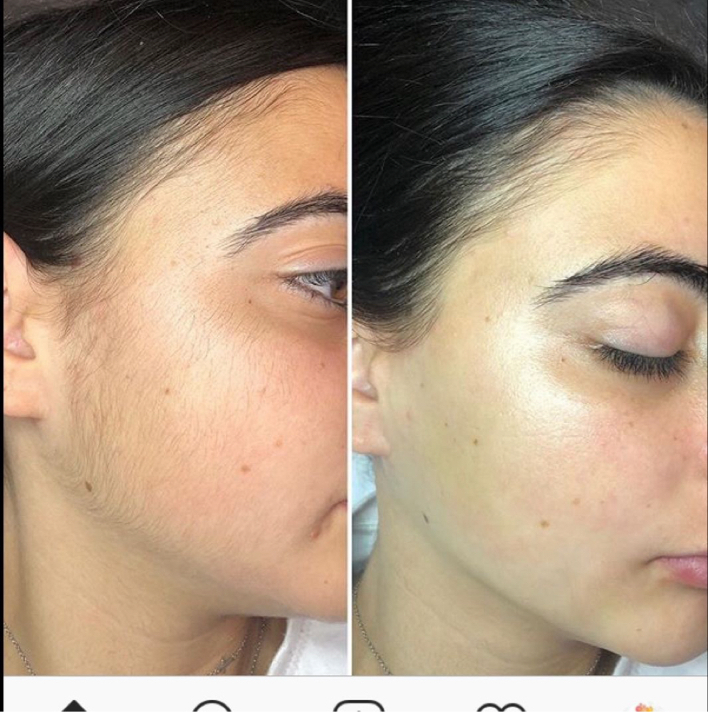 Face Waxing at Beauxfemmesesthetics in Conroe, TX