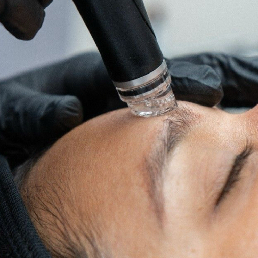 JANUARY HYDRAFACIAL & DERMAPLANE