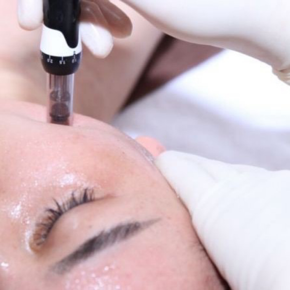 K-Beauty Nano Facial at Soothing Studio in The Colony, TX