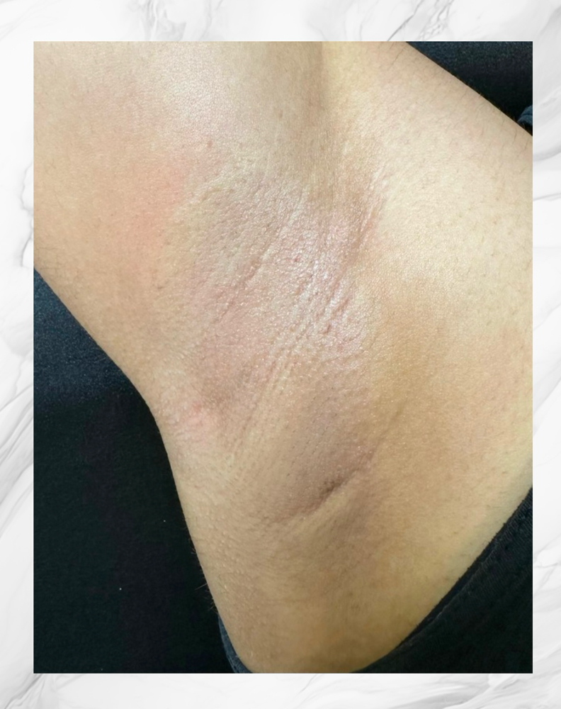 Under Arms Wax