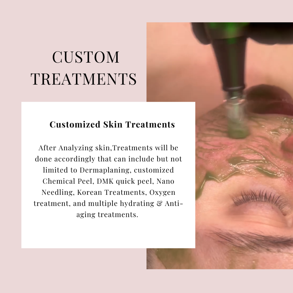 Custom Treatments + Chemical Peels