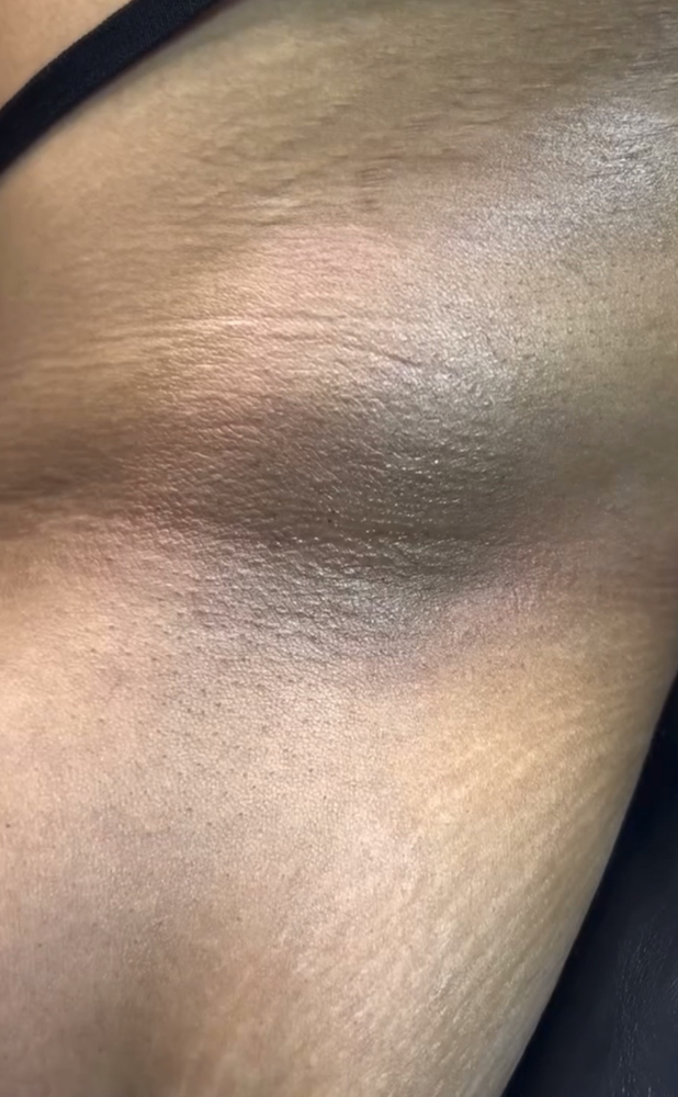 Underarms