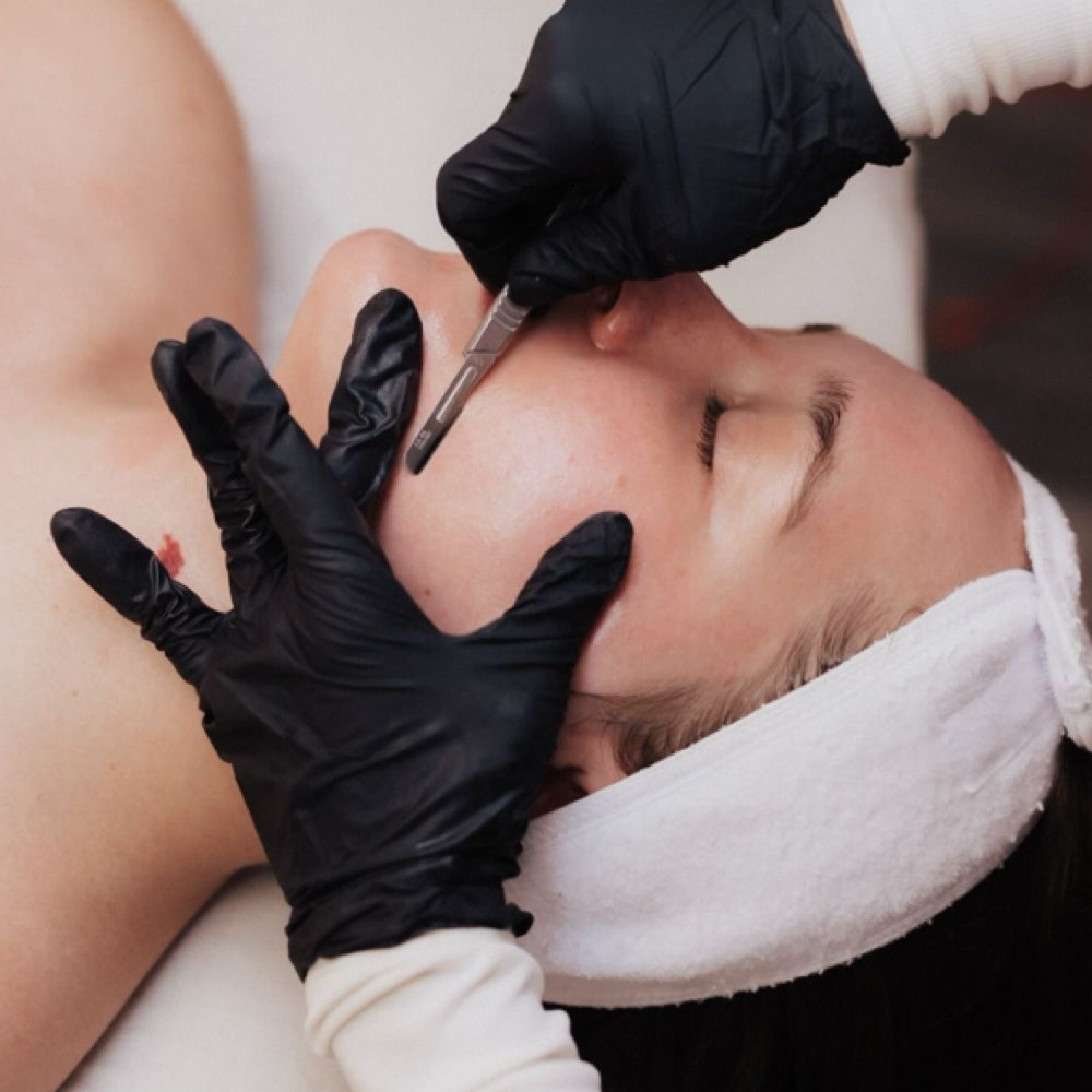 Dermaplane Add On at Serene.Esthetics in Franklin Square, NY