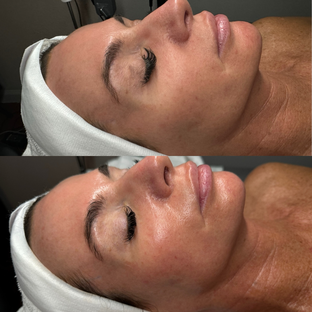 Anti-Aging Facial