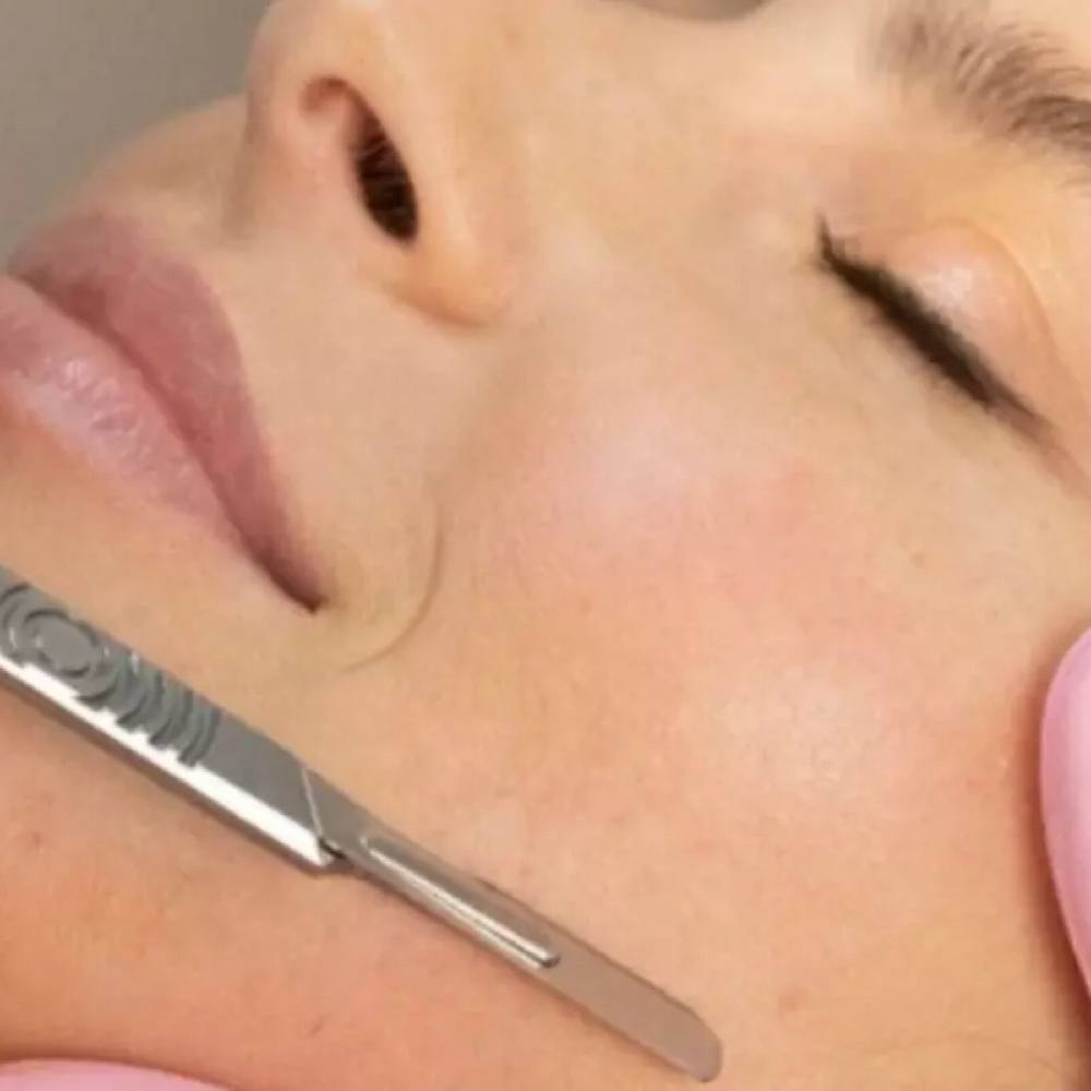 Dermaplaning Facial at CJM Esthetics in Houston, TX