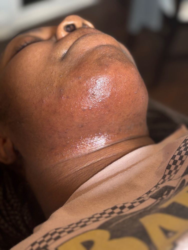 Chin & Neck Wax at FACED AESTHETICS in Riverdale, GA