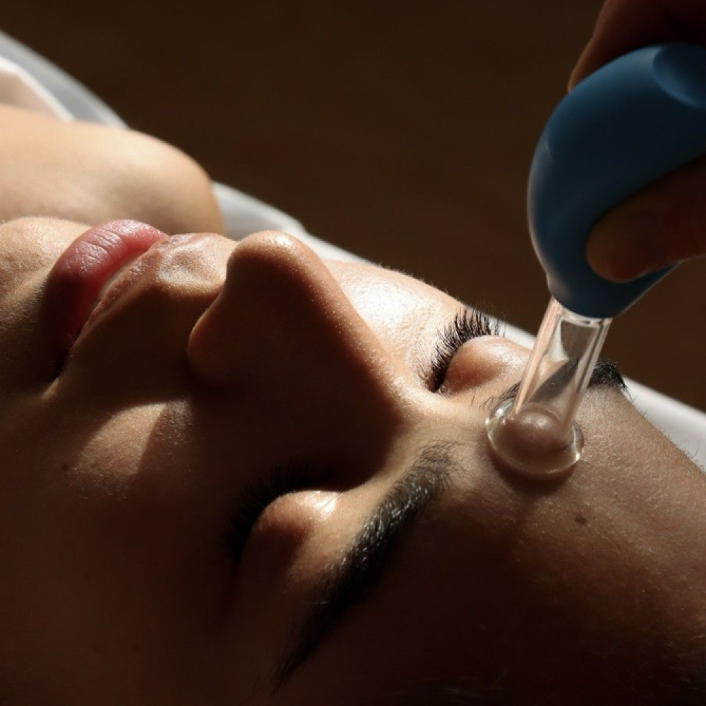 Facial Cupping at NEW Me Skinbar in Rochester, MN