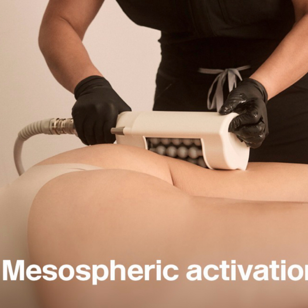 T-Shape2 Mesospheres™ Therapy at Lashesbyty LLC in Ridgeland, MS