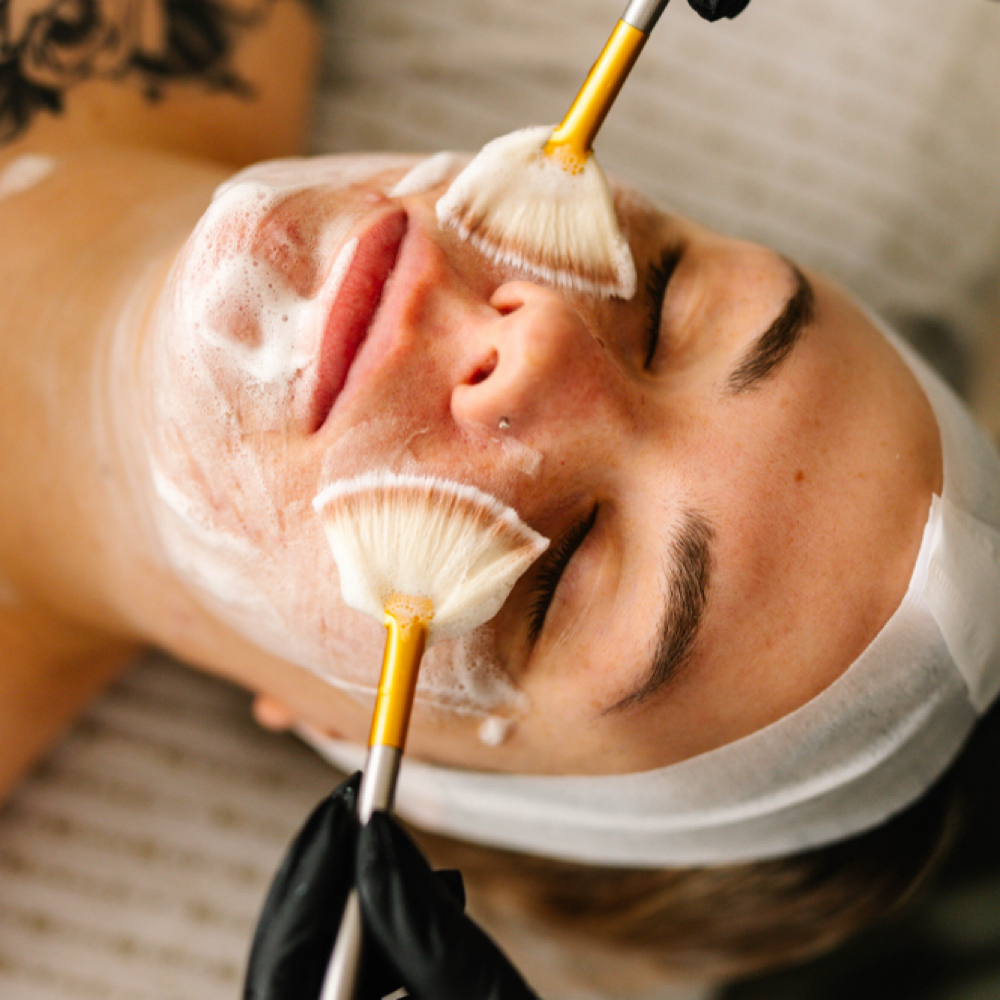 Micro Dermabrasion Elite at Body By Ally in Chicopee, MA