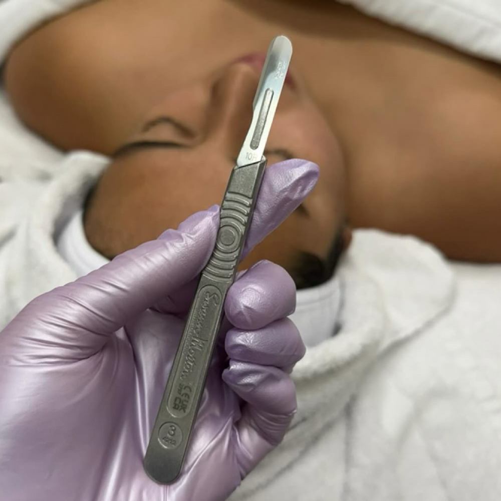 Dermaplaning (ADD-ON) at Danielle Skintegrity in West Palm Beach, FL