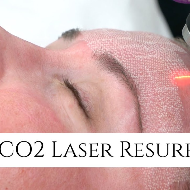 CO2 Laser Treatment at Studios Secrets in Dallas, TX