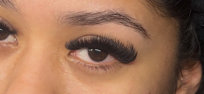 3 Week Volume Fill
