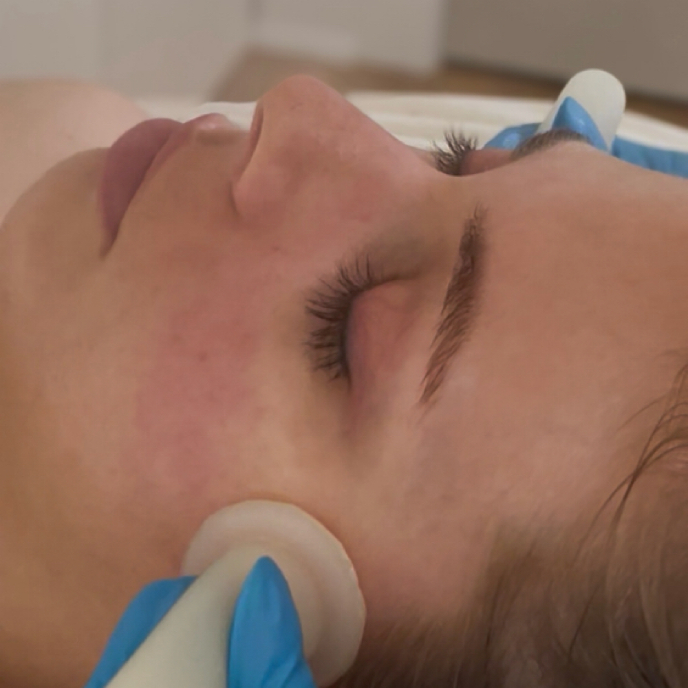 Glow & Go Facial Cupping Massage at Qēt Botanicals in Fort Atkinson, WI