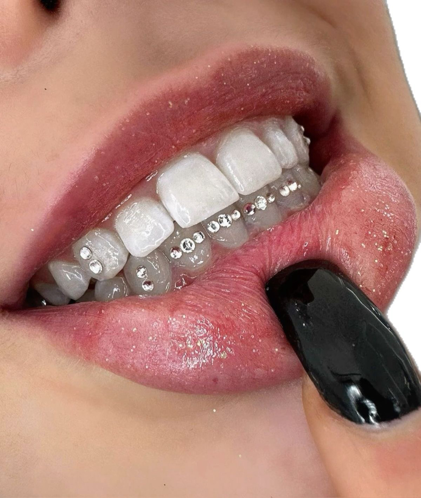 4 TOOTH GEM BRACE BAR ONLY
