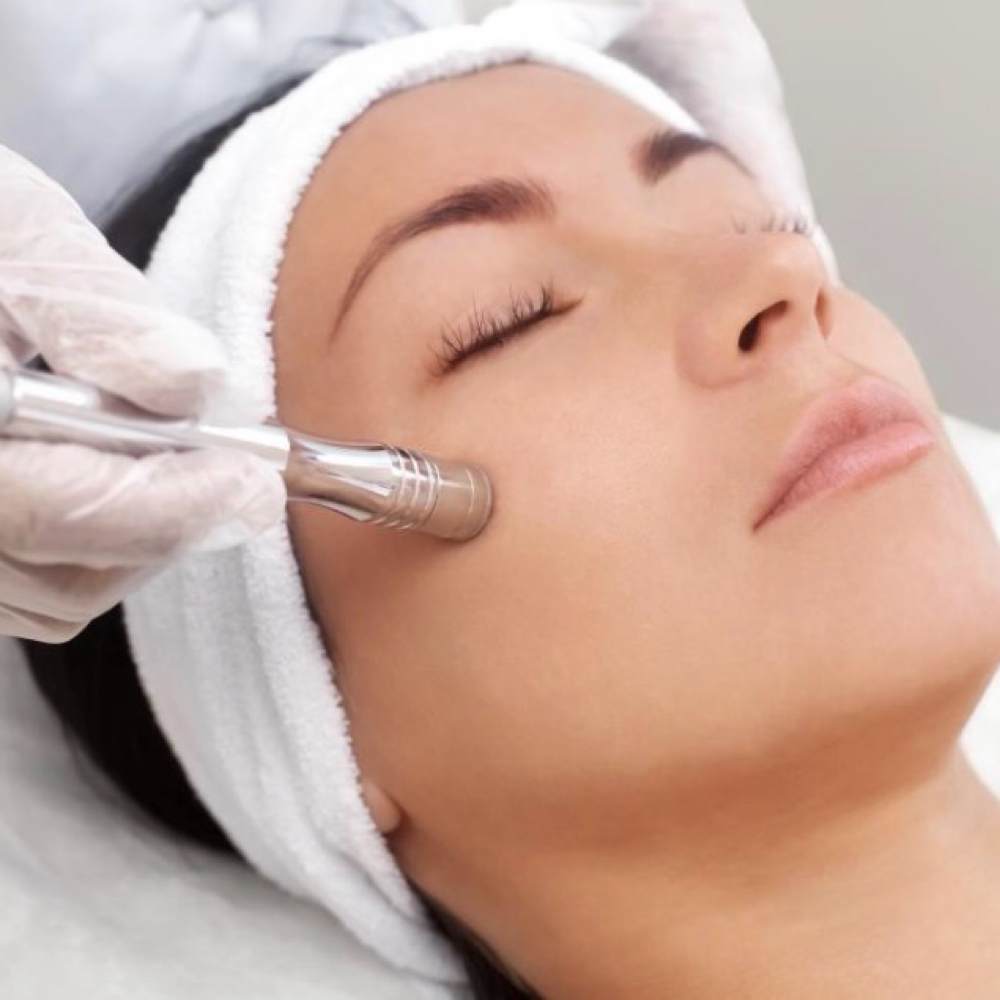 Add On Microdermabrasion at Re Nu Esthetics by Trina in Ardmore, OK