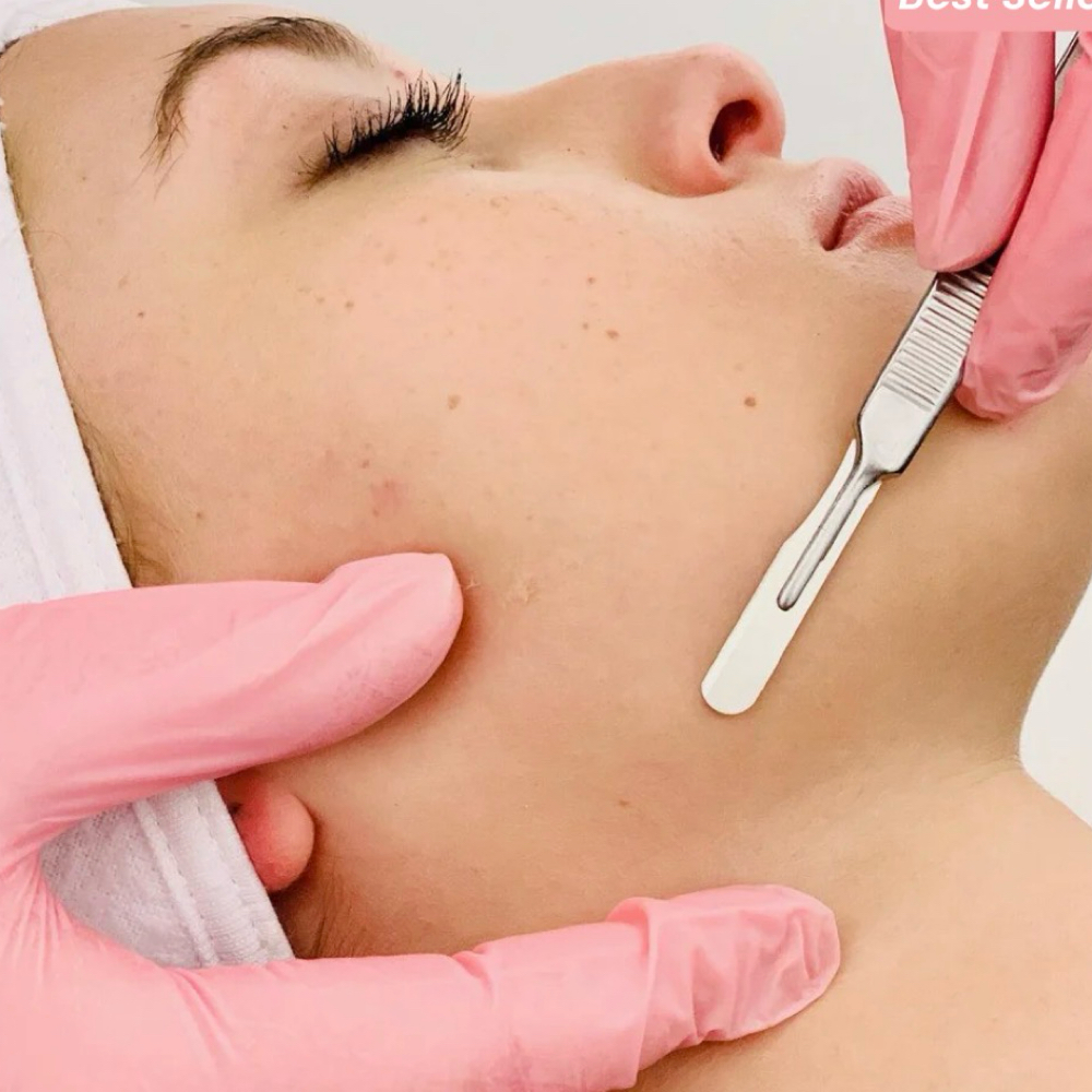 Add Chin/Lip Dermaplane
